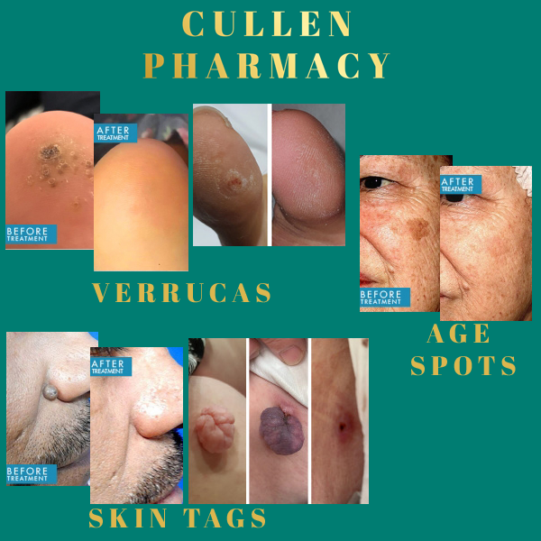 Cullen Pharmacy Skin Clinic Results